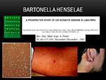  Bartonella henselae 