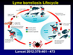 Lyme borrellosis