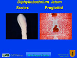 Dyphyllobothrium latum