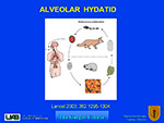 Alveolar Hydatid