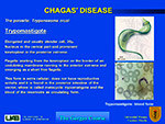  Chagas Disease 