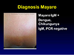  Diagnosis Mayaro 