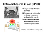 Enteropathogenic E coli