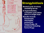  Strongyloidiasis 