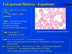 Falciparum malaria