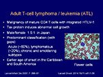 Adult T cell lymphoma