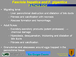  Fasciola hepatica