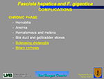  Fasciola hepatica 