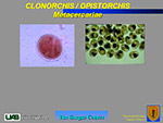  Clonorchis 