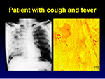 Patient with cough
