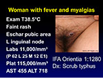  Woman with fever 