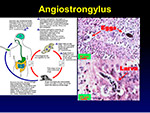 Angiostrongylus