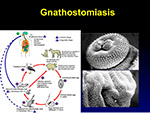 Gnathostomiasis