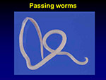 Passing worms