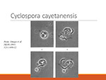  Cyclospora 