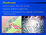 Hookworm