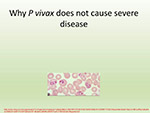 Why P vivax 