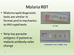 Malaria RDT