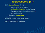 Tuberculoid