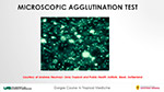 Microscopic Agglutination Test