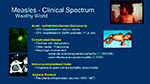 Clinical Spectrum
