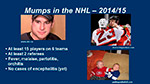 Mumps in the NHL