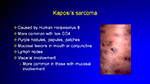 Kaposi s sarcoma