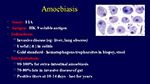 Amoebiasis