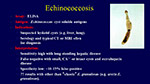 Echinococcosis