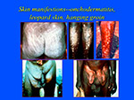 Skin manifestations