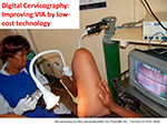 Digital Cervicography