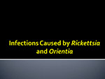 Infections 