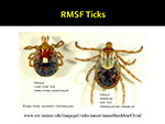 RMSF Ticks