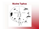  Murine Typhus 