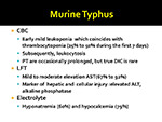  Murine Typhus 