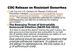 CDC Release