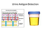 Urine Antigen