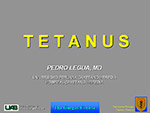  Tetanus 