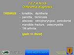  Tetanus 