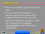  Typhoid fever 