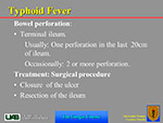  Typhoid Fever 