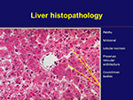 Liver Histopathology