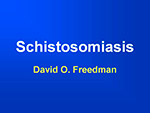  Schistosomiasis 