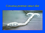 Cercariae pentrate