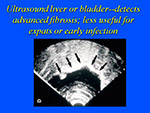 Ultrasound liver