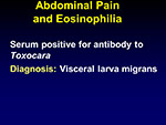 Abdominal pain