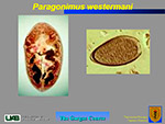 Paragonimus westermani