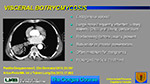 Visceral Botryomycosis 