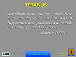  Tetanus 