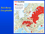 Tick Borne Encephalitis